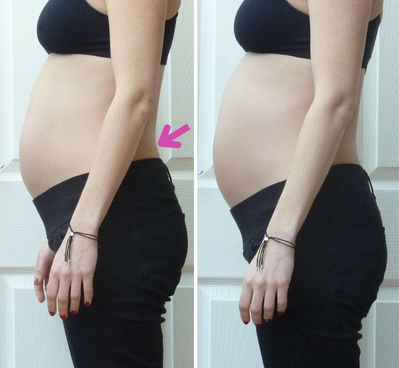 This before-and-after image shows a pregnant woman’s posture during the second trimester and her baby’s position, demonstrating the effects of the Buttafly Technique.

In the first photo (left), we can see that while her posture is fairly well-aligned overall, there is a distinct over-arch or "hinge" in her lower back.

In the second photo, after a 20-minute session with the Buttafly Technique, her spine and pelvis are more naturally aligned and the baby position is considerably changed.